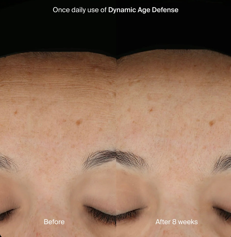 DYNAMIC AGE DEFENSE