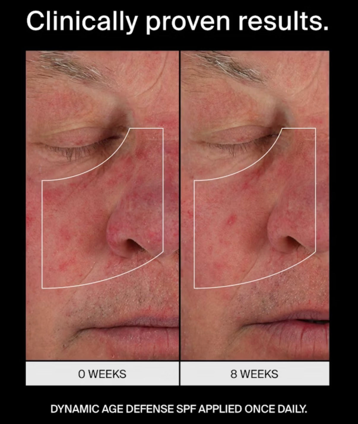 DYNAMIC AGE DEFENSE