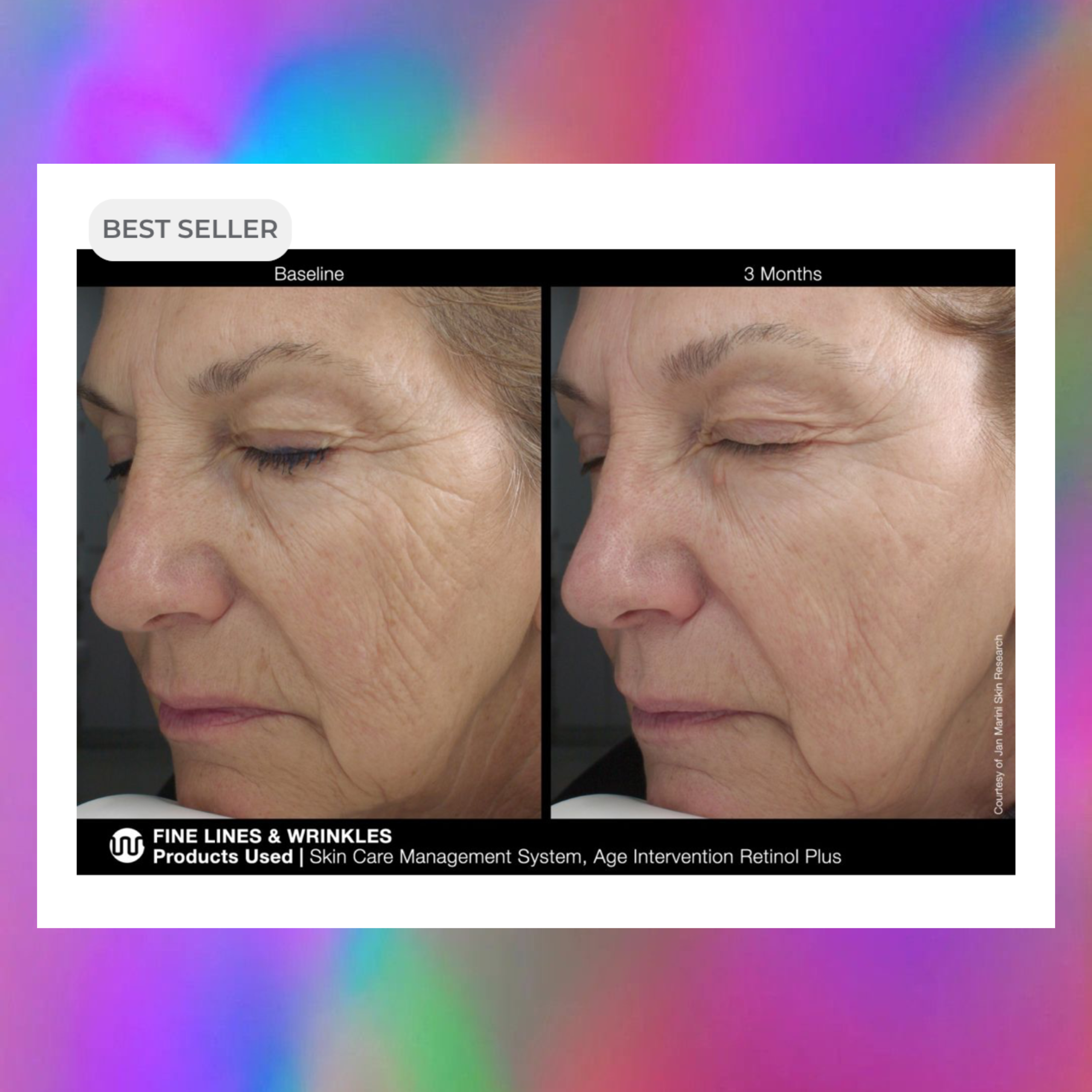 AGE INTERVENTION RETINOL PLUS