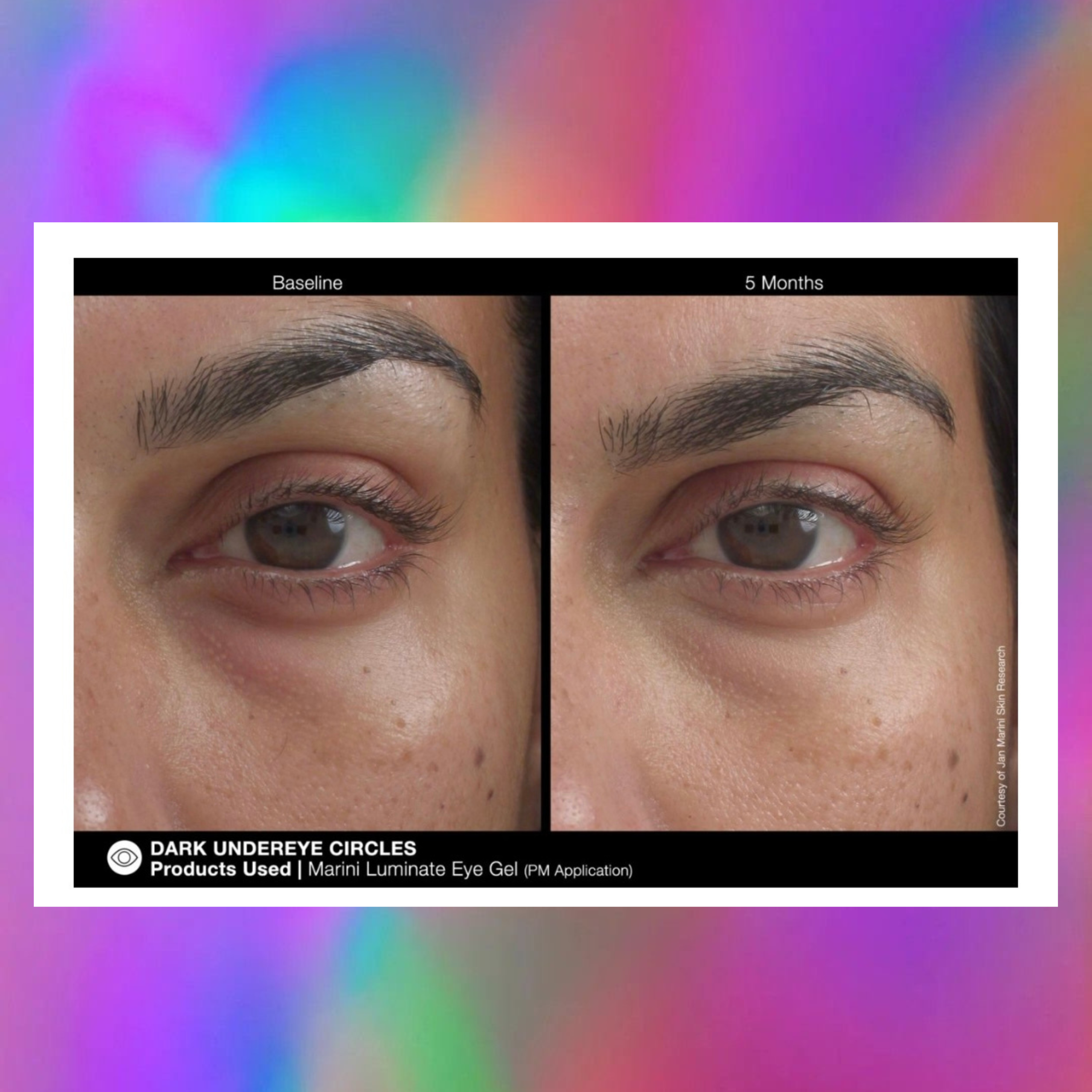 LUMINATE EYE GEL