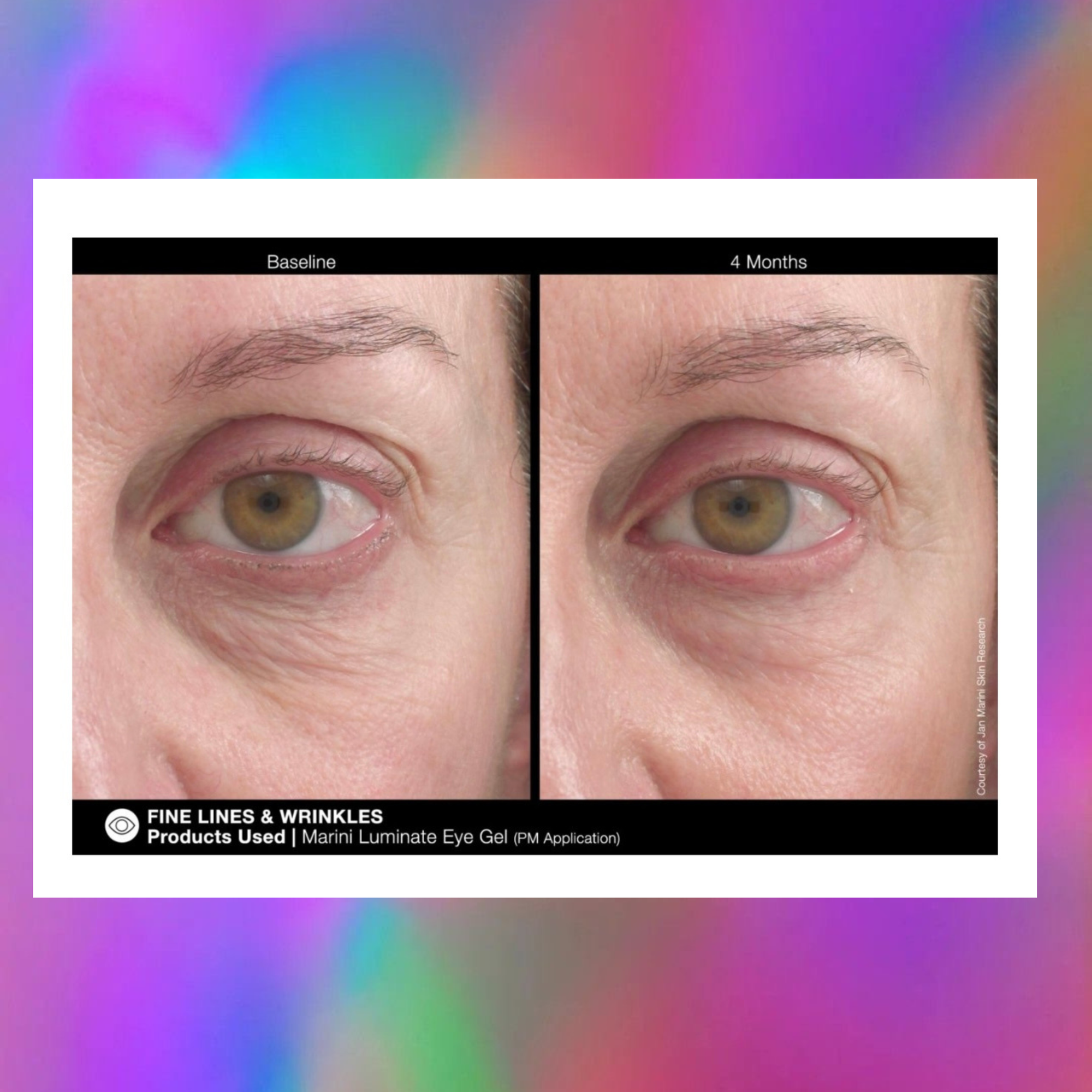 LUMINATE EYE GEL