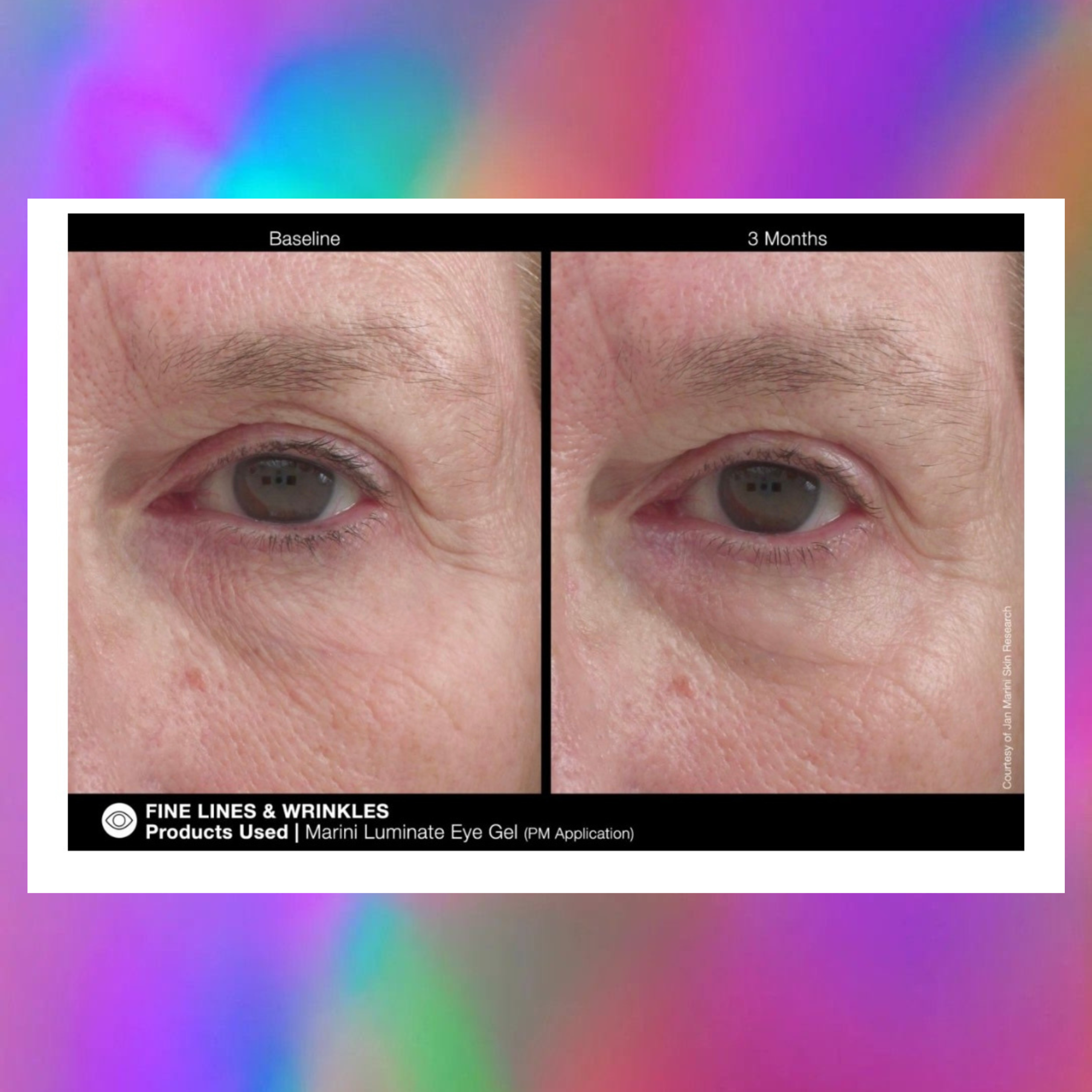 LUMINATE EYE GEL