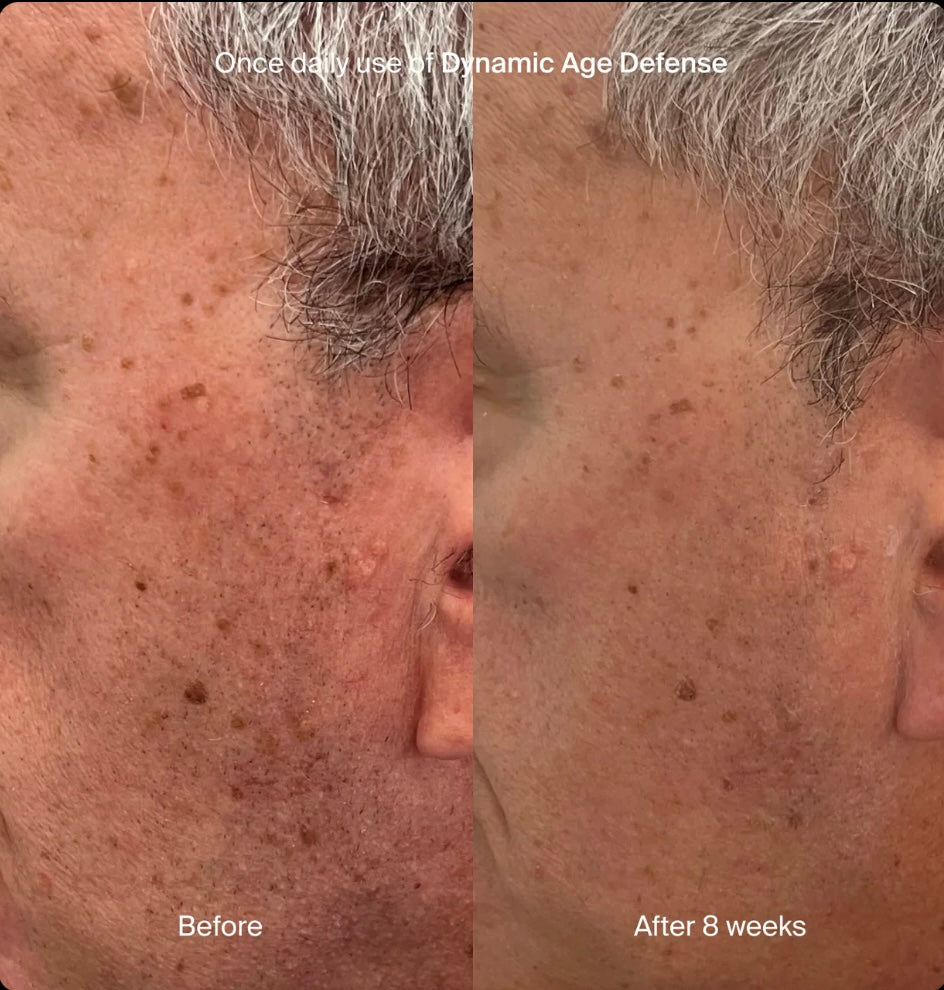 DYNAMIC AGE DEFENSE