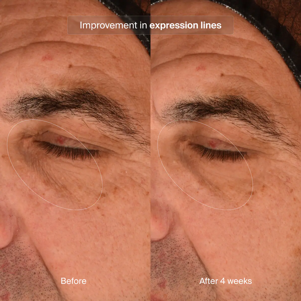BIOADAPTIVE STRESS REPAIR
