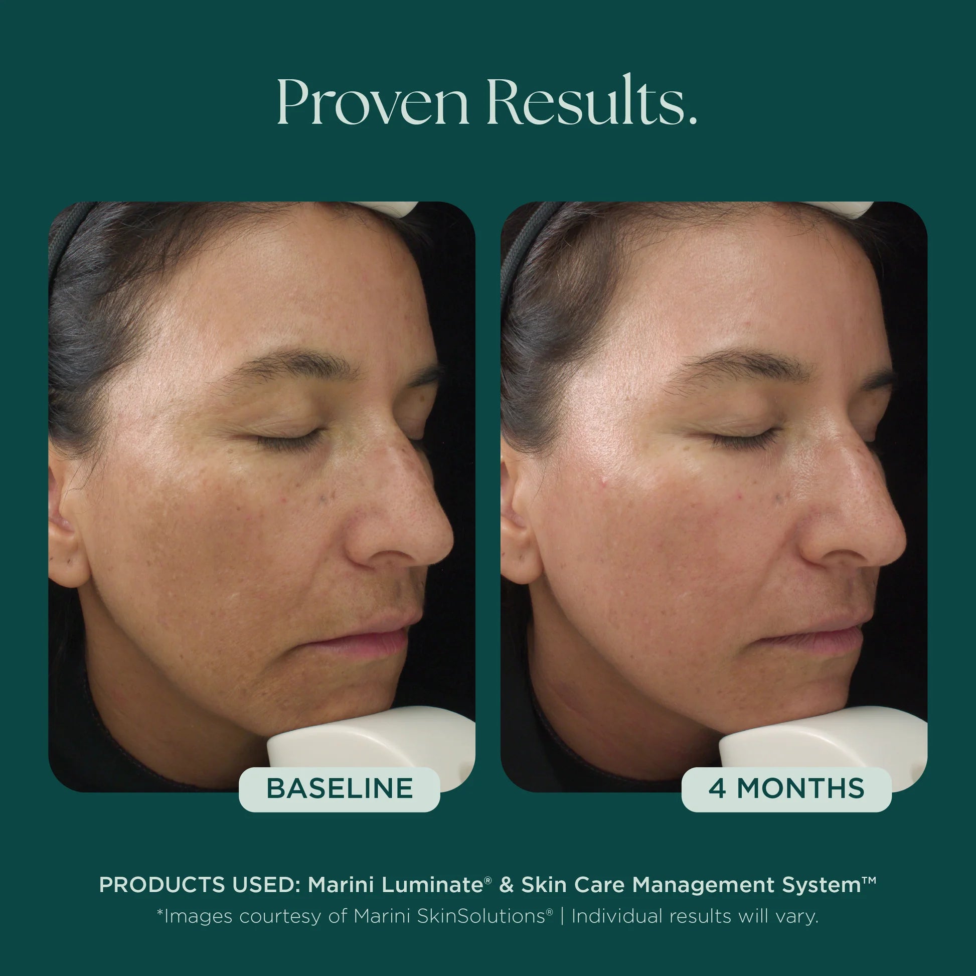 LUMINATE FACE LOTION