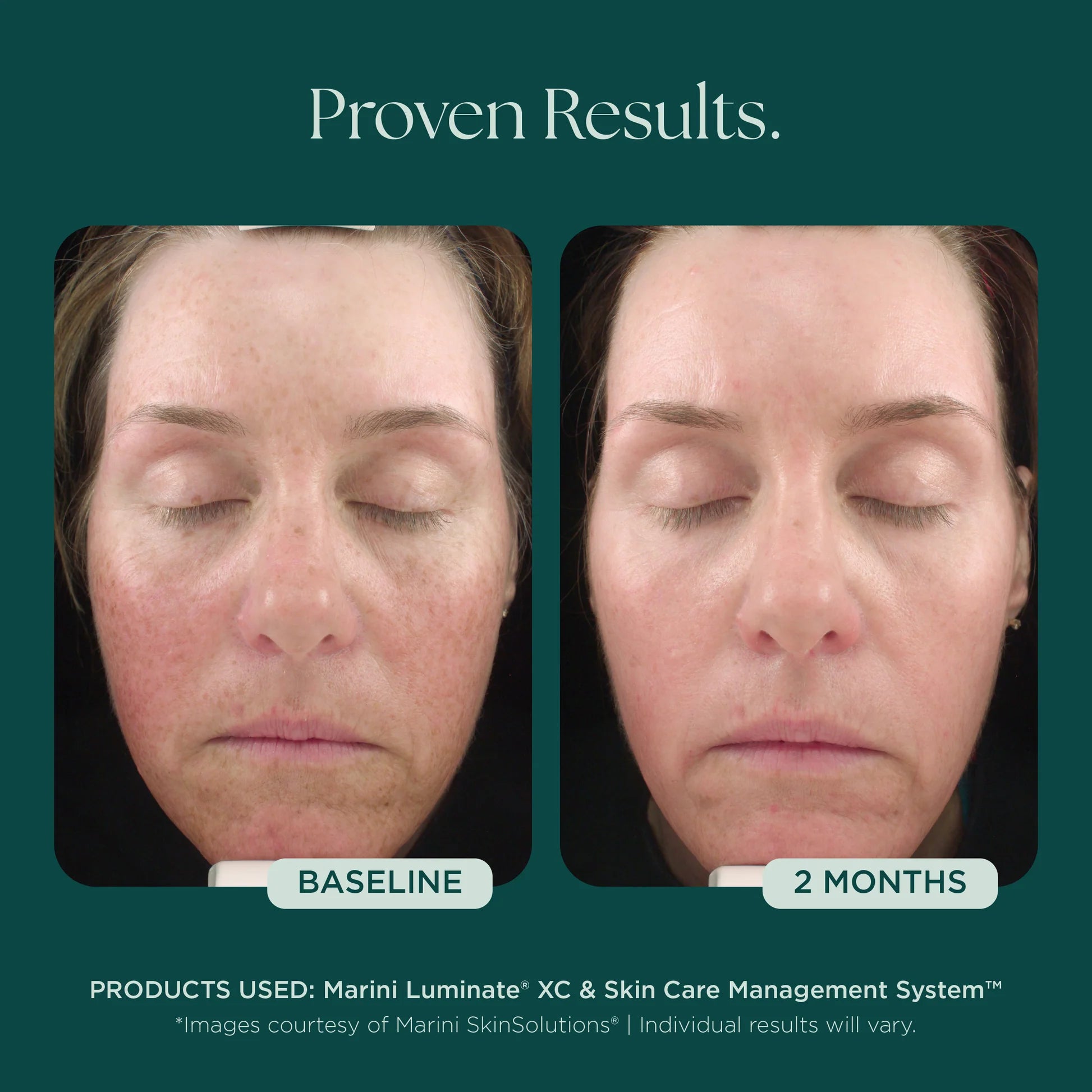 LUMINATE FACE LOTION