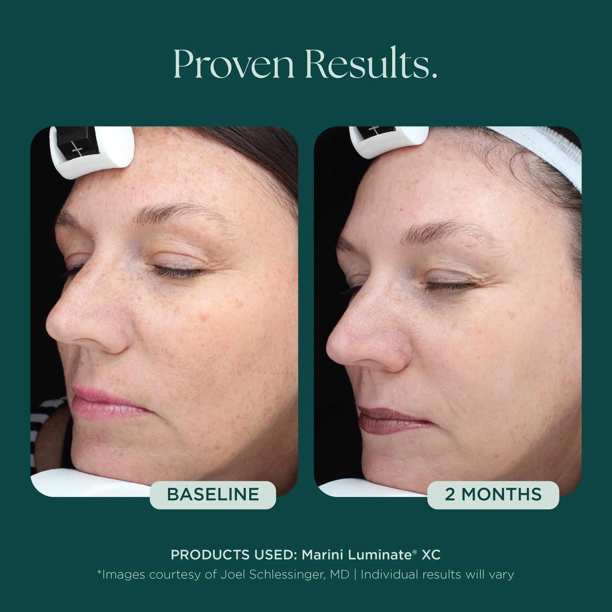 LUMINATE FACE LOTION