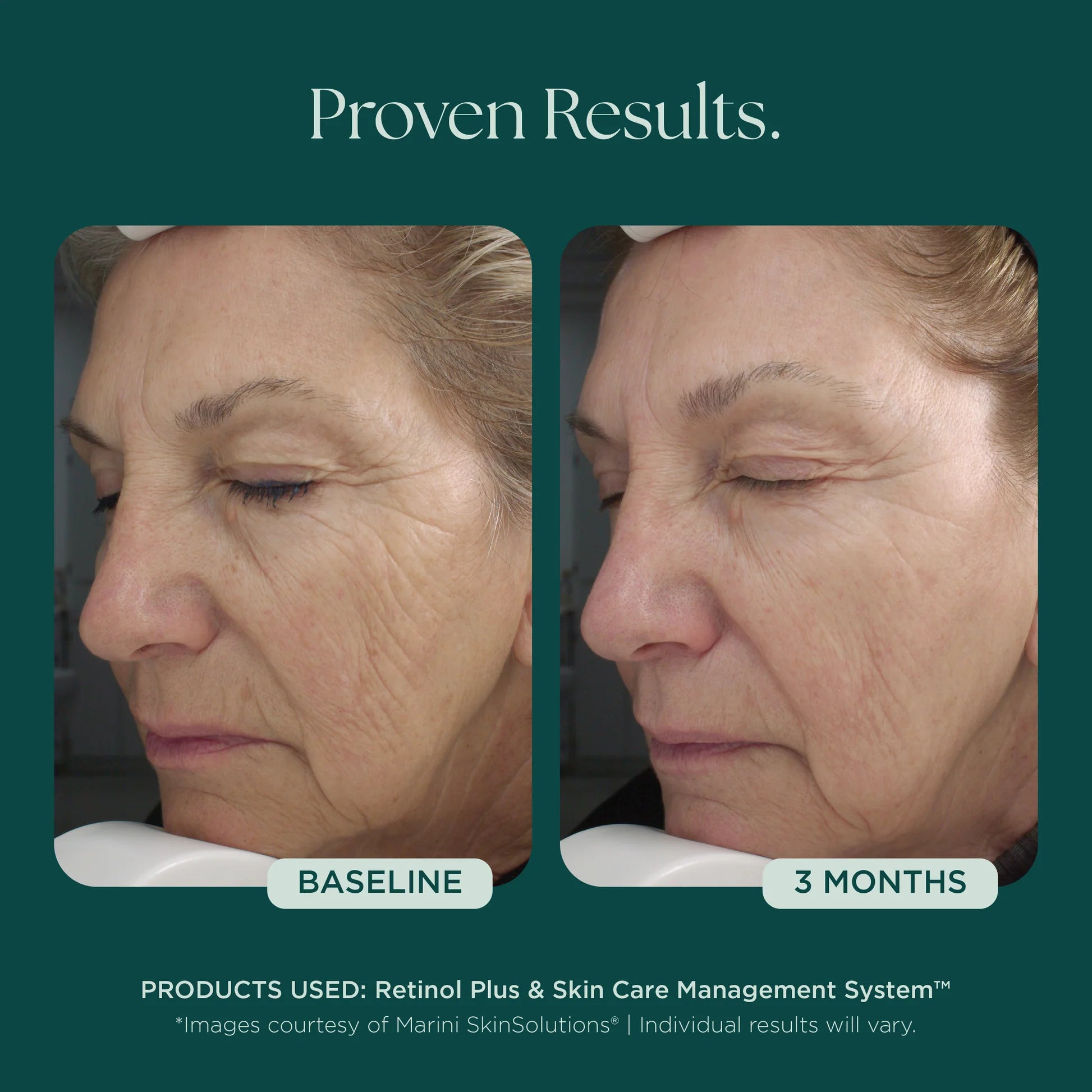 RETINOL PLUS