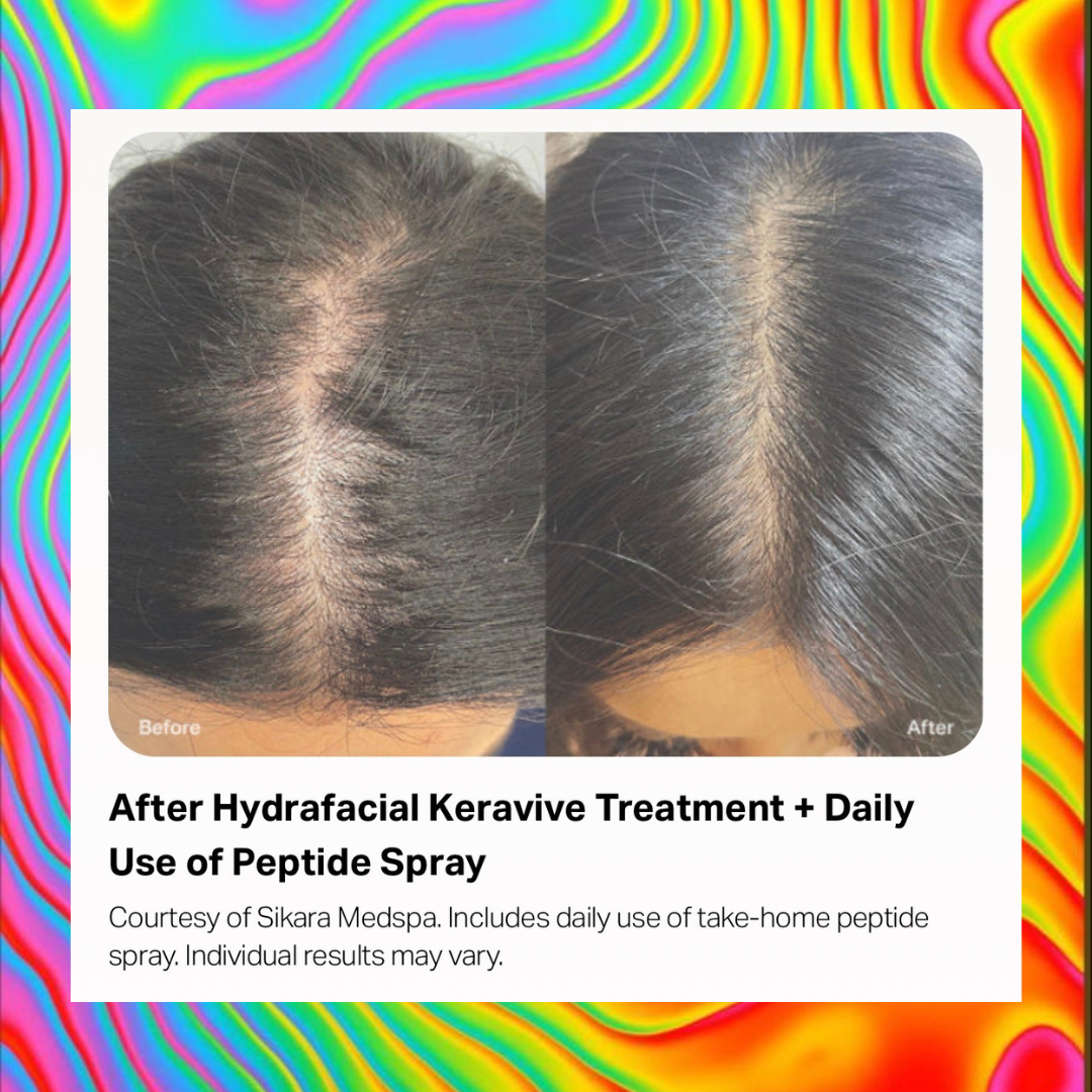 HYDRASCALP WITH KERAVIVE