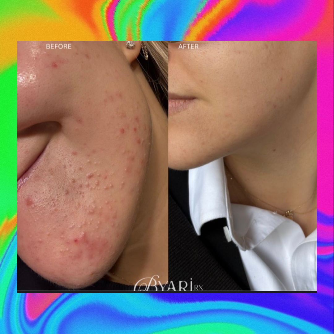 BYARI SEABUCKTHORN SKIN OIL