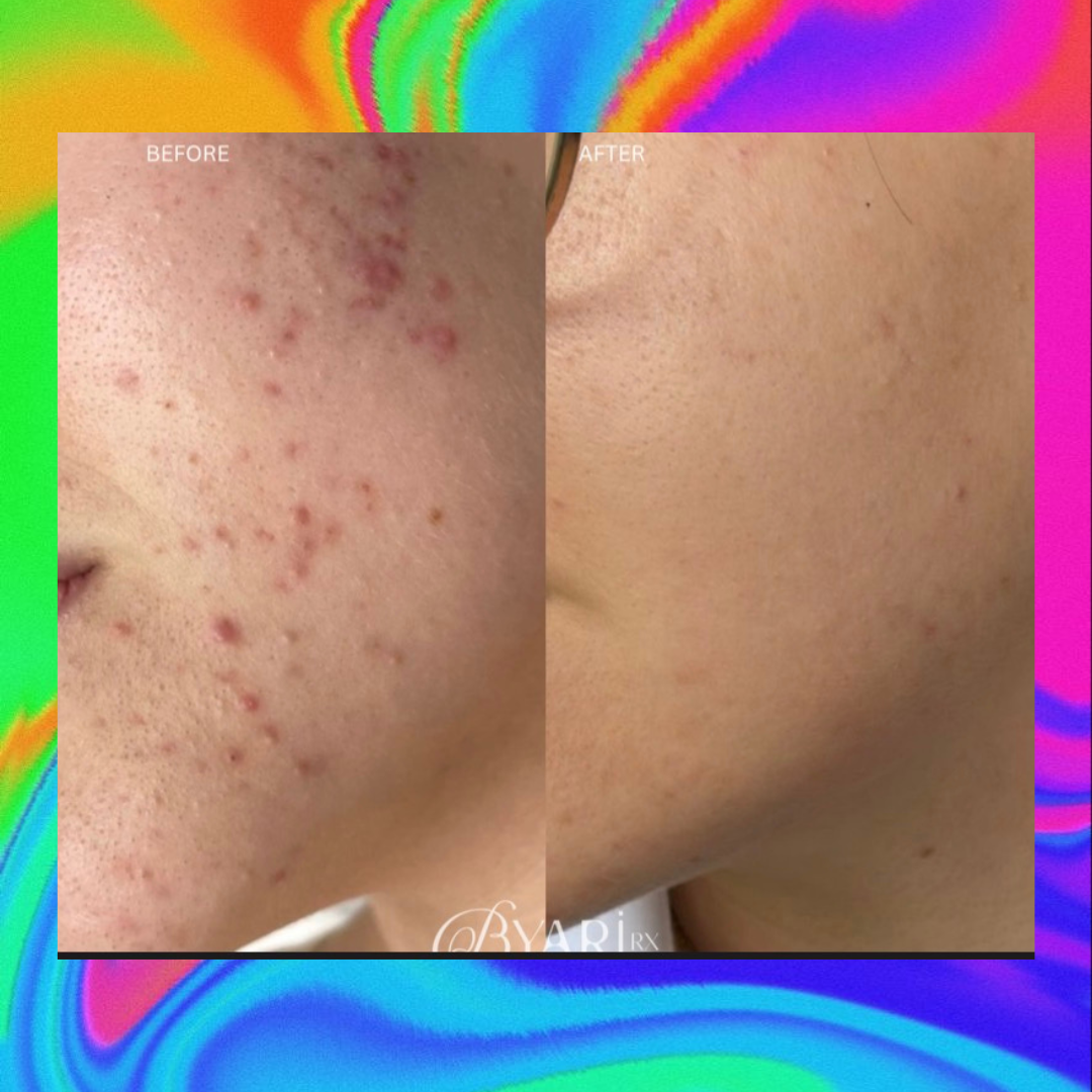 BYARI SEABUCKTHORN SKIN OIL